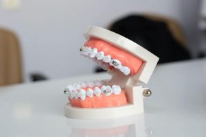 Co to znaczy ortodonta