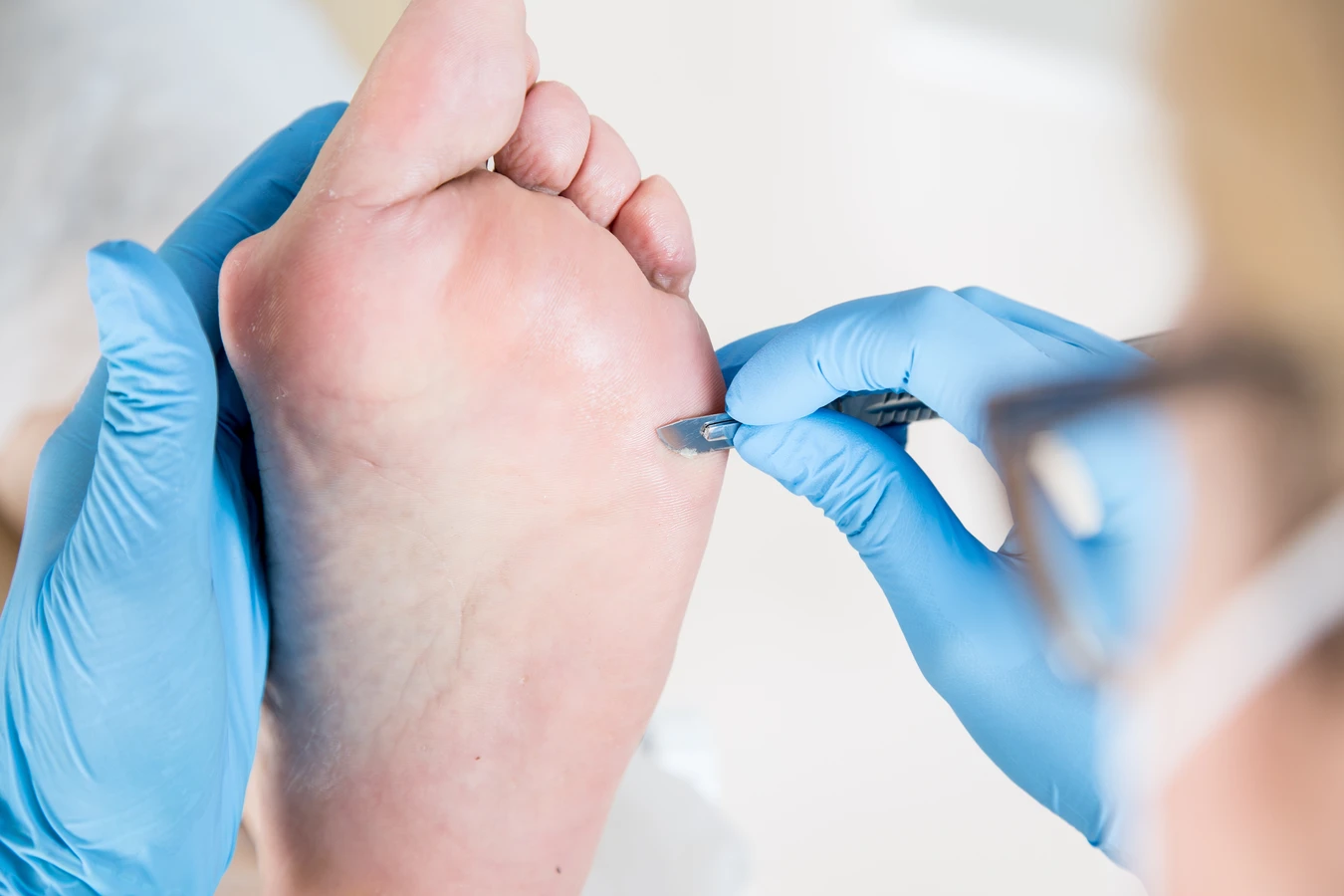Podologia - co oznacza ten termin?